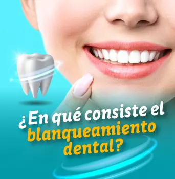 Lo que debes saber sobre el blanqueamiento dental con láser