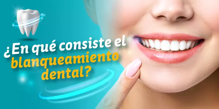 Financiación blanqueamiento dental